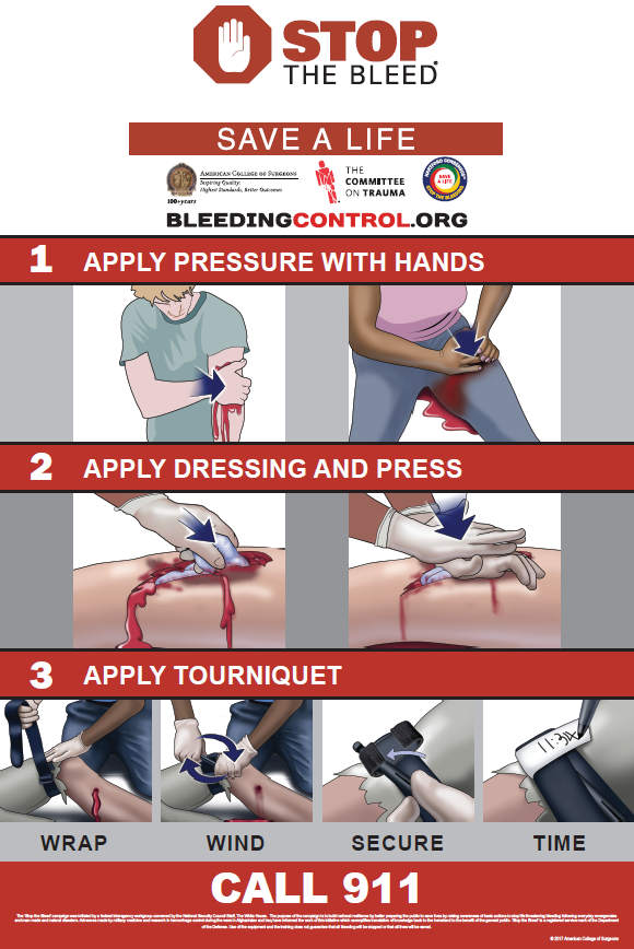 Poster describing the Stop the Bleed steps taught in the class